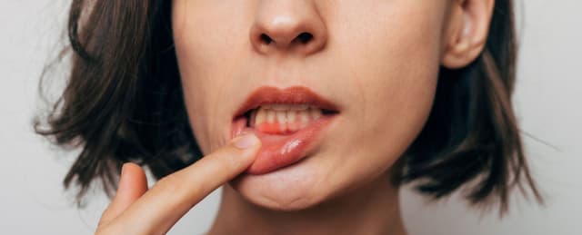 إهمال نظافة الفم قد يزيد مخاطر أمراض القلب