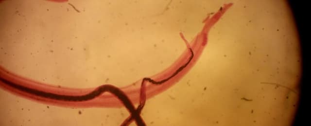 إصابتك بهذه الدودة الطفيلية قد توقف قدرتك على الشعور بالألم!