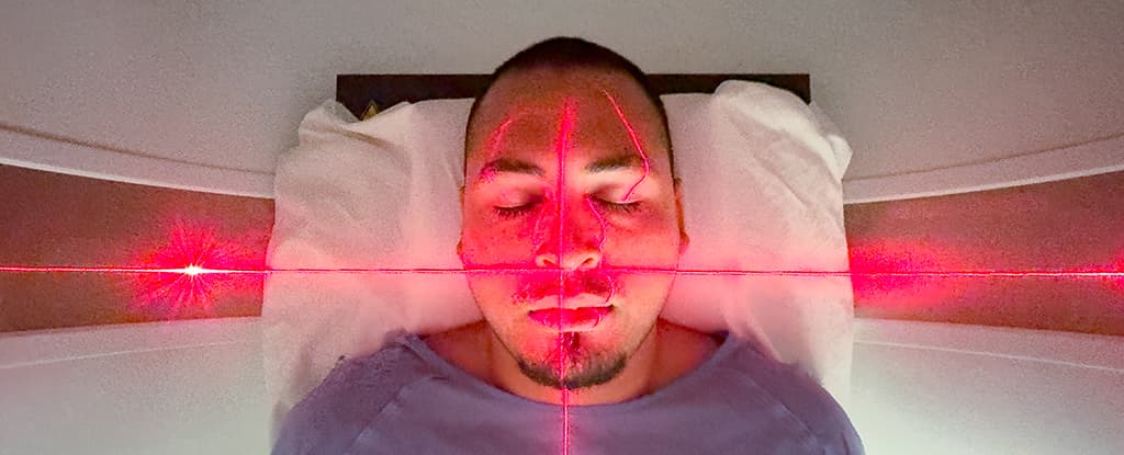 العلاج الإشعاعي يخفف الألم الناتج عن أكثر أشكال التهاب المفاصل شيوعًا