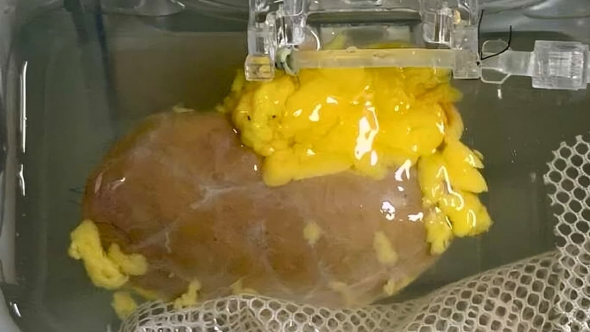 إنجاز علمي: ابتكر العلماء كلية تتوافق مع كل فصائل الدم!