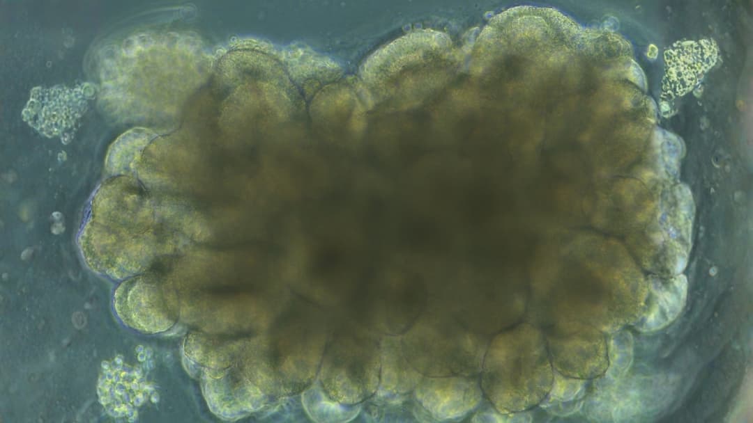 علماء يطورون أدمغة صغيرة في المختبر ثم يدربونها على حل مشكلات هندسية!