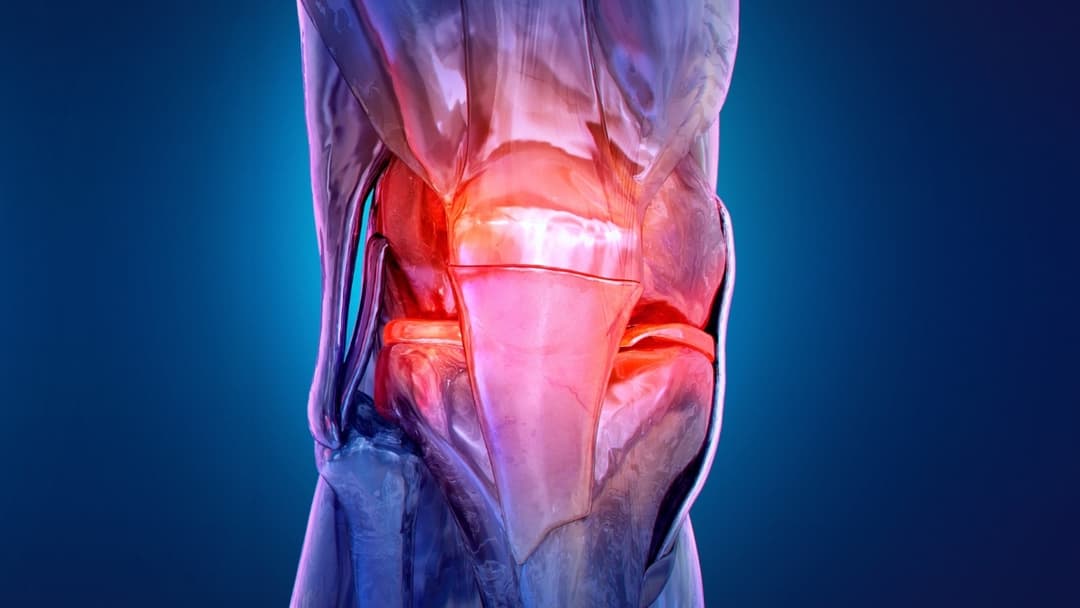 الفصال العظمي يظهر لدى البالغين الأصغر سنًا!