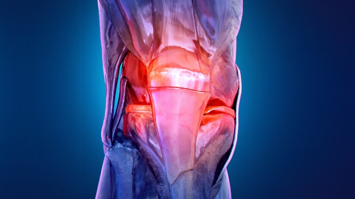 الفصال العظمي يظهر لدى البالغين الأصغر سنًا!