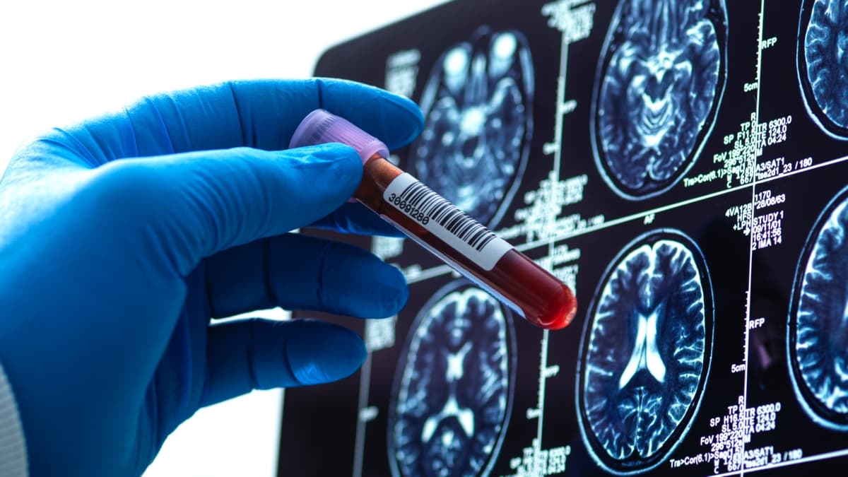 اكتشاف فصيلة دم هجينة نادرة للغاية لدى 3 أشخاص فقط!