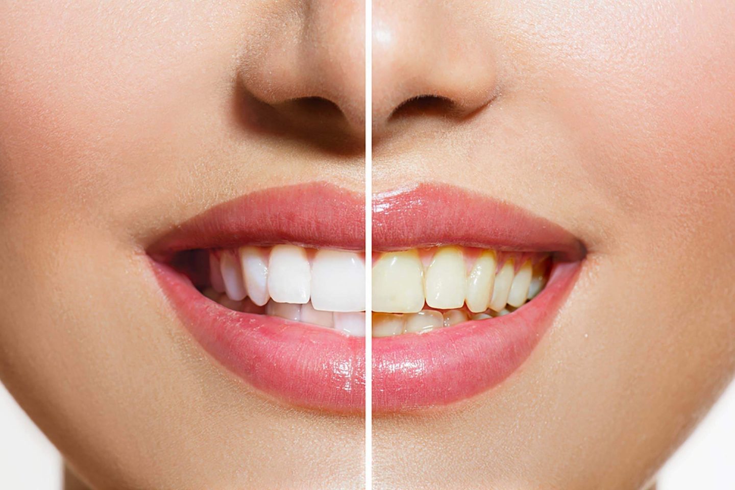 ھل الأسنان الصفراء طبیعیة أم علامة على سوء الحالة الصحیة؟