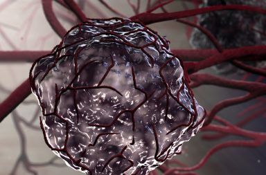 ما الفرق بين الأورام الحميدة الأورام الخبيثة الاورام السرطانية الحميدة الخلية السرطانية الخلايا التي تتحول إلى سرطان خلل في عمل الحمض النووي