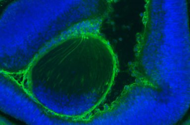 لأول مرة: توليد ملايين الخلايا البشرية الناضجة في جنين الفأر - توليد ملايين الخلايا البشرية الناضجة داخل جنين الفأر - الخلايا الجذعية