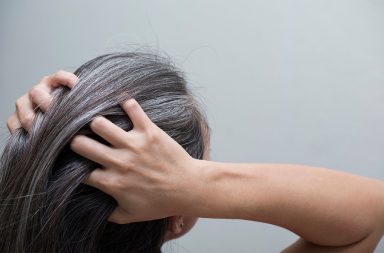 دث الشيب عادة بسبب موت الخلايا الصباغية في بصيلات الشعر ببطء مع تقدمنا في السن. هل توجد هناك علاقة بين الشيب في الشعر و التعرض للتوتر الشيب؟