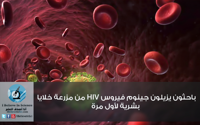 باحثون يزيلون جينوم فيروس HIV من مزرعة خلايا بشرية