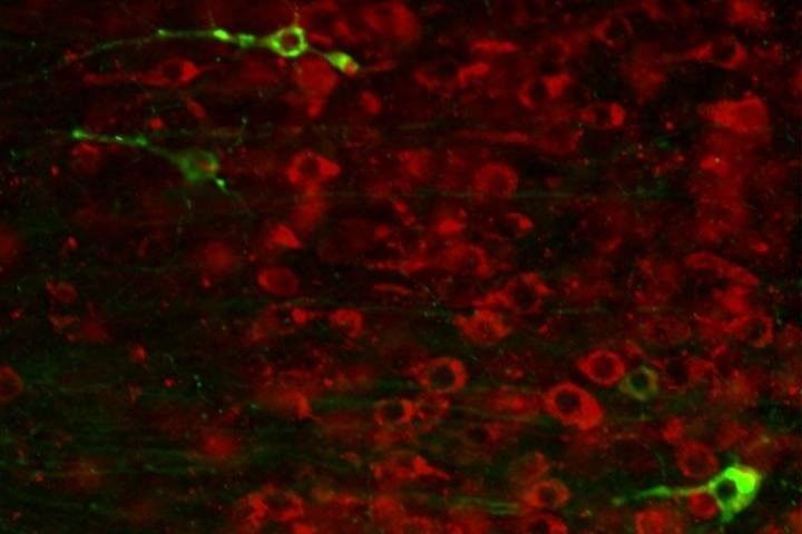 مركّب دوائي يعكس بعض الأضرار العصبية التي يسببها الزهايمر في الفئران