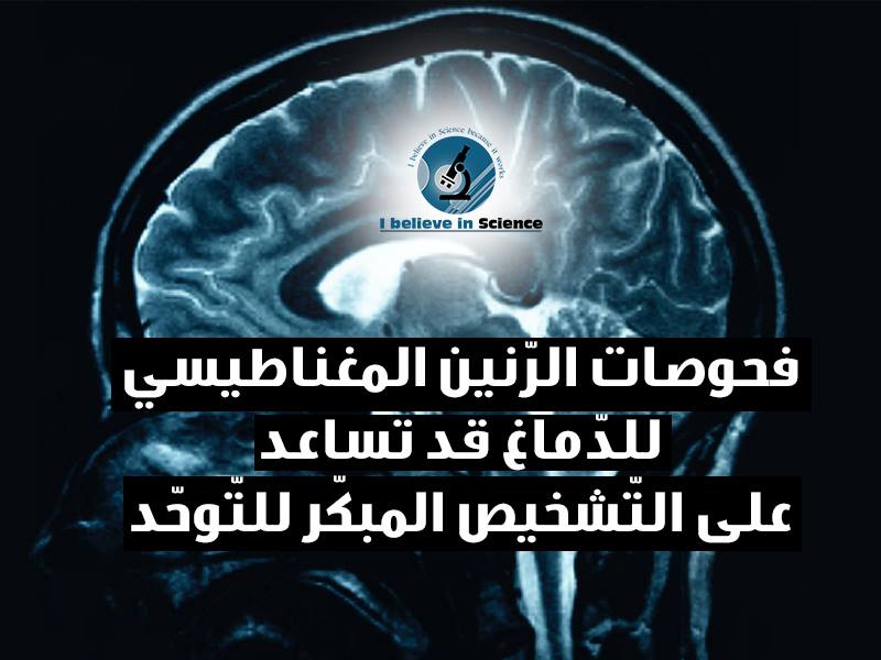 فحوصات الرنين المغناطيسي للدماغ قد تساعد على التشخيص المبكر للتوحد