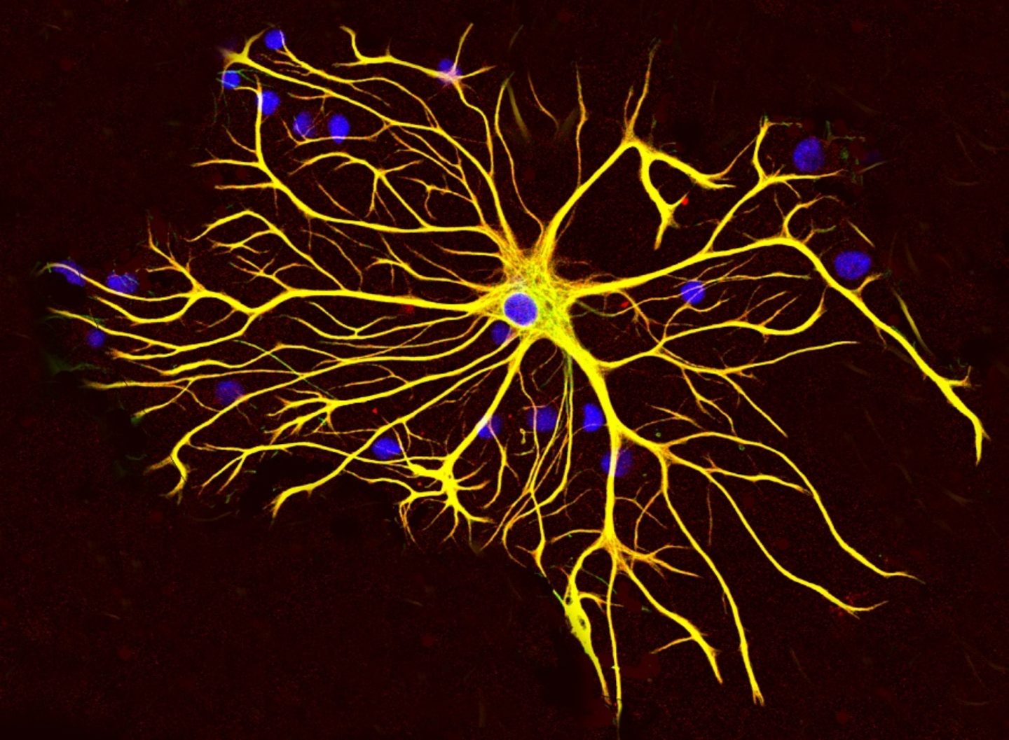 كيف يتم ترميم النسيج العصبي بعد الاذية ؟ و ما هو دور الخلايا النجمية ؟