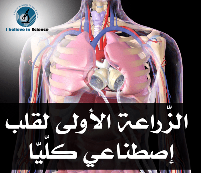 الزراعة الأولى لـقلب إصطناعي كليا