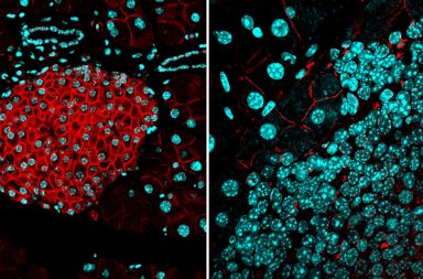 دراسة جديدة ضخمة للجينوم تكشف أسرارًا غامضة عن كيفية تشكل الورم السرطاني - تسلسل جينومات عشرات من أنواع السرطان - الأورام السرطانية