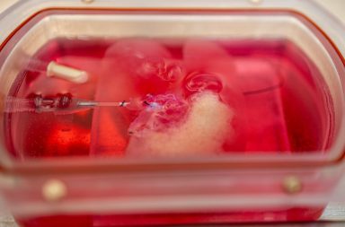 لأول مرة: نجاح زراعة كبد بشري صغير مخبري في الفئران - زراعة أكباد بشرية صغيرة في الفئران - خلايا جلد بشرية أُعيدت برمجتها