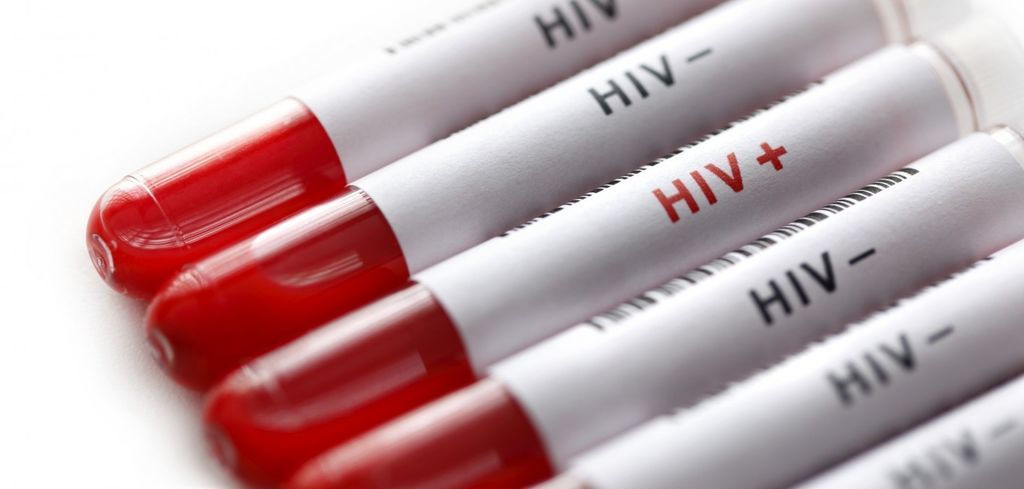 بحث جديد على الحمل الفيروسي لفيروس HIV يؤكد على ضرورة تحديث المبادئ التوجيهية للعلاج التي وضعتها منظمة الصحة العالمية