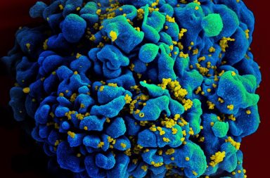 وجد باحثون أن أحد الأدوية المؤثرة في الجهاز المناعي والمستخدم على نطاق واسع في علاج السرطان يمكنه أن يخرج فيروس نقص المناعة البشرية الكامن HIV من مخابئه
