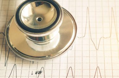 تسرع القلب البطيني غير المنتظم من نوع تورساد دي بوانت - الأسباب والأعراض والتشخيص والعلاج - اضطرابات نظم القلب المهددة للحياة