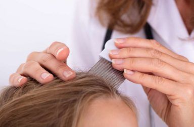 كيف نفرق بين قمل الرأس و القشرة أعراض القشرة أعراض قمل الرأس طريقة علاج قشرة الشعر كيفية علاج القمل الوقاية من الإصابة بالقمل