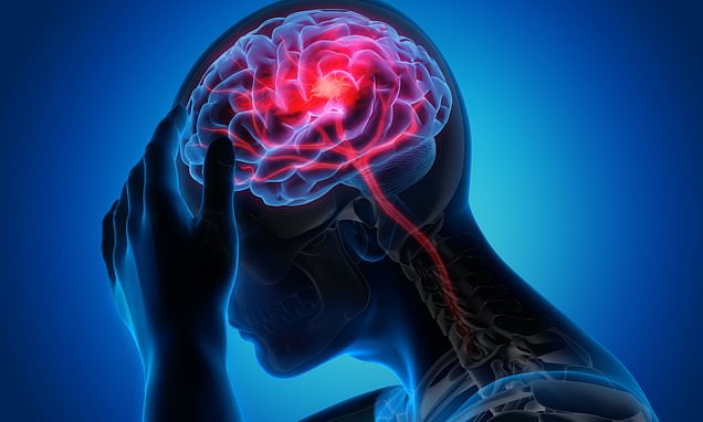 تهدئة الأعصاب مفرطة الاستثارة تحمي الدماغ بعد السكتة الدماغية