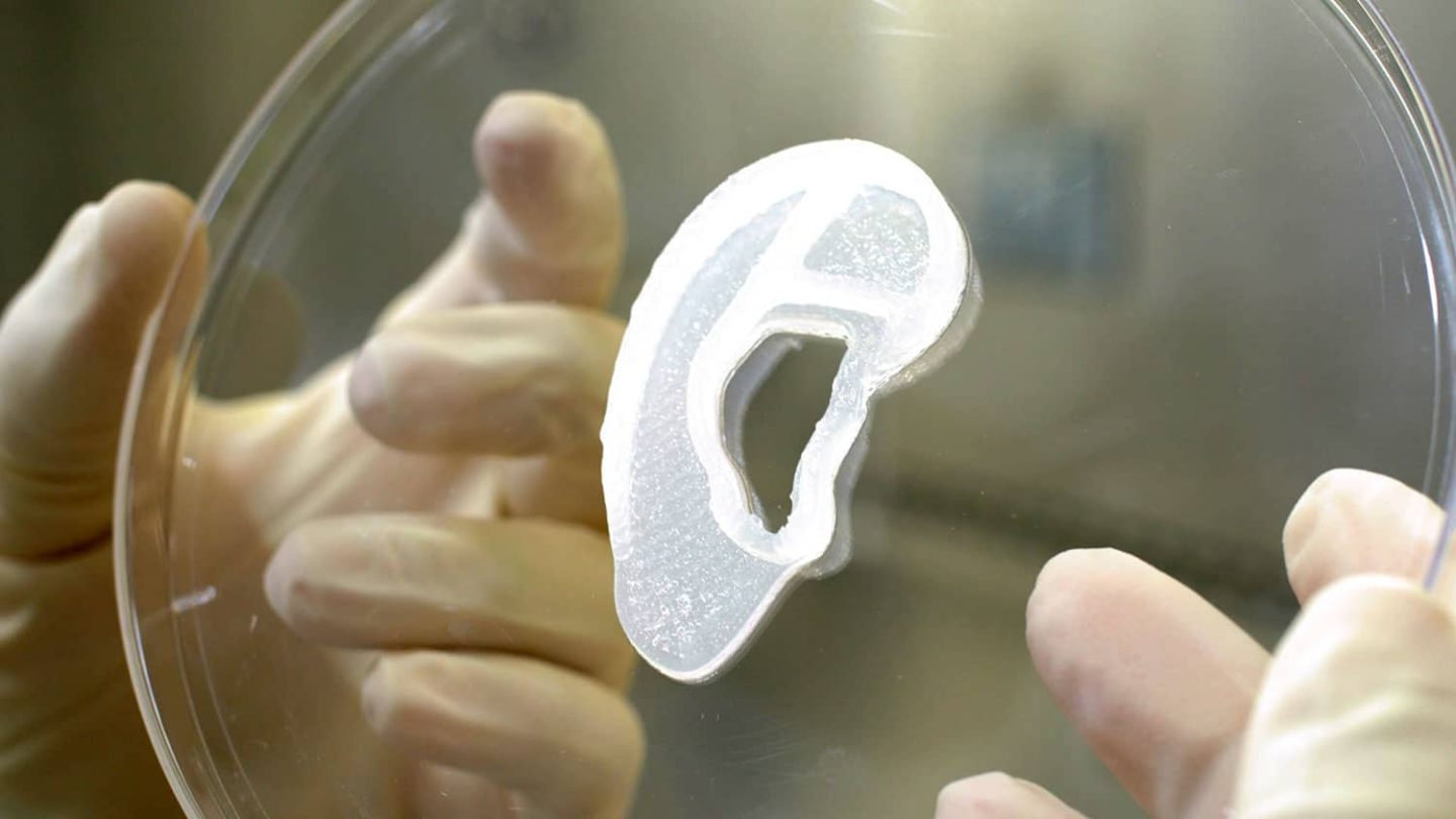 زرع أذن مأخوذة بيولوجيًا من المريض ذاته مطبوعة بتقنية الطباعة ثلاثية الأبعاد