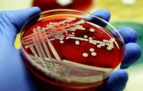 استراتيجيات جديدة لمكافحة الجراثيم المقاومة للمضادات الحيوية