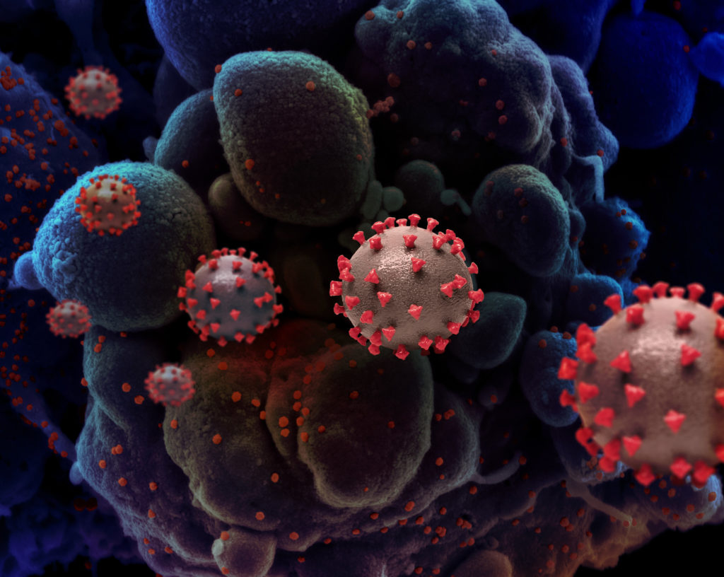 متغاير جديد من فيروس كورونا يهيمن على العدوى عالميًا