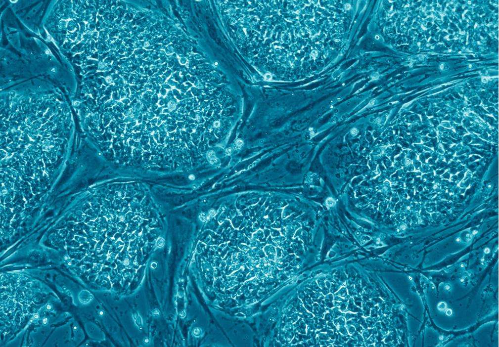 تقنية « CRISPR » تسمح للعلماء باستكشاف كل خطوات الصحة و المرض في كل انواع الخلايا ! لكن كيف تعمل ؟