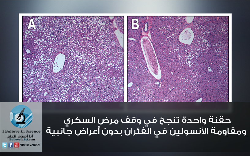 حقنة تنجح في وقف مرض السكري ومقاومة الأنسولين