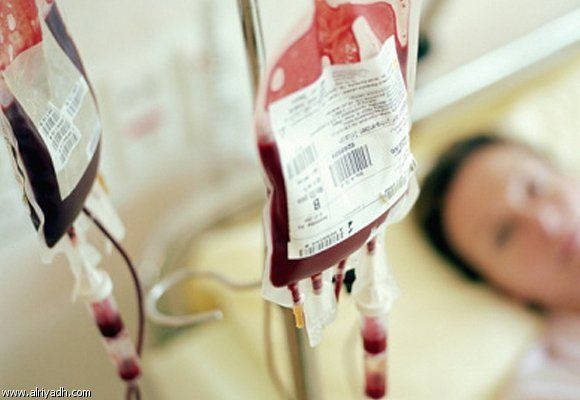 ماذا يحدث للمريض اذا نقل له دم قديم