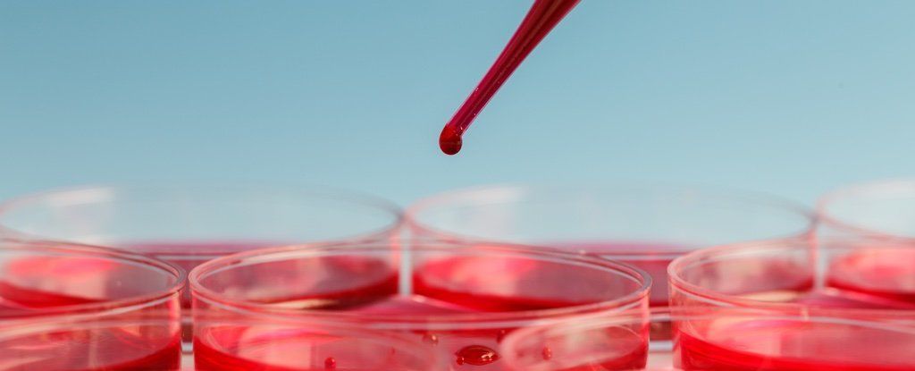 اختبار جديد يمكنه الكشف عن كل عدوى بكتيرية معروفة تصيب دمك في وقت واحد