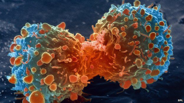 إيجاد ثغرة في الخلايا السرطانية