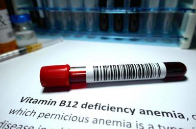 كيف تعرف إذا كنت تعاني من فقر الدم الخبيث كريات الدم الحمراء نقص فيتامين B12 أمراض المناعية الذاتية فقر الدم الوبيل الأنيميا