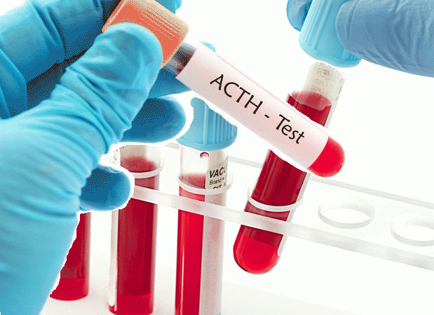 اختبار الهرمون الموجه لقشر الكظرية ACTH: دواعي الإجراء والتحضير والنتائج