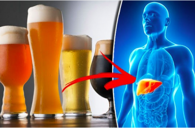 أعراض التهاب الكبد الكحولي أسباب الإصابة بالتهاب الكبد الكحولي العلاج الوقاية شرب كميات كبيرة من الكحول فشل الكبد التلف الكبدي