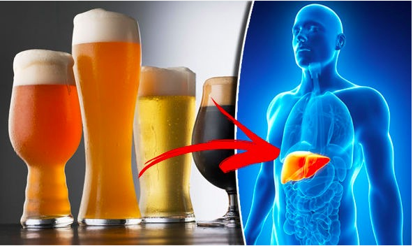 التهاب الكبد الكحولي