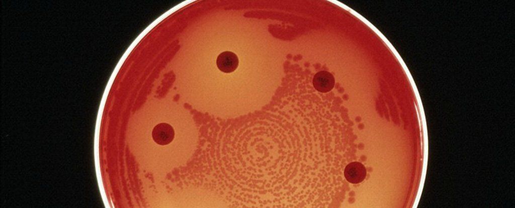 للاسف اول حالة وفاة نتيجة بكتيريا مقاومة لكل المضادات الحيوية