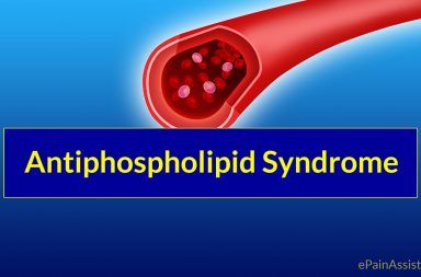 متلازمة أضداد الفوسفوليبيد أسباب متلازمة أضداد الفوسفوليبيد الأعراض التشخيص العلاج الحمل الدم الشرايين الأوعية الدموية أجسام مضادة