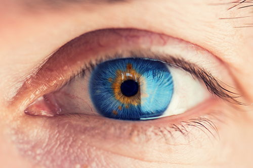 هل يمكن أن يتغير لون العيون؟ وهل يدل تغيّره المفاجئ على مشكلة طبية؟