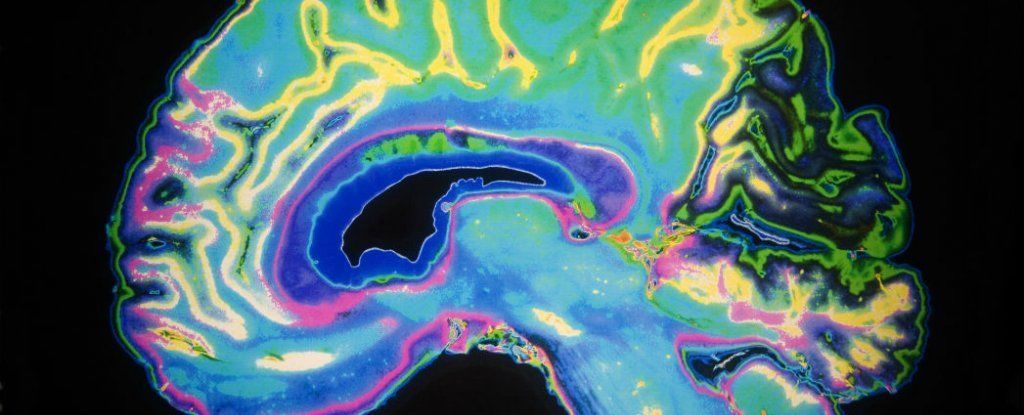 علماء الأعصاب يتابعون كيفية تحرك الفكرة داخل الدماغ وهذا ما وجدوه
