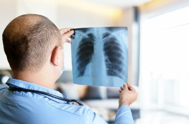 تستخدم الأشعة السينية جرعة صغيرة من الإشعاع المؤيّن لتصوير الصدر لتقييم حالة الرئتين والقلب وجدار الصدر - تصوير الصدر بالأشعة السينية