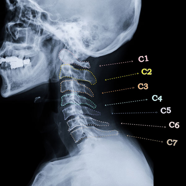 العمود الفقري الرقبي: كل ما تريد معرفته