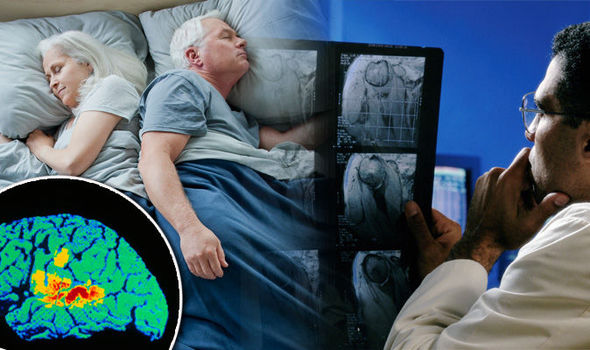 دراسة تؤكد العلاقة بين انقطاع التنفس في أثناء النوم وداء ألزهايمر