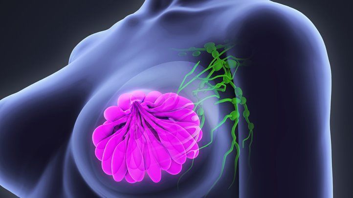 أول علاج مناعي لمرضى سرطان الثدي تصادق عليه إدارة الغذاء والدواء الأمريكية