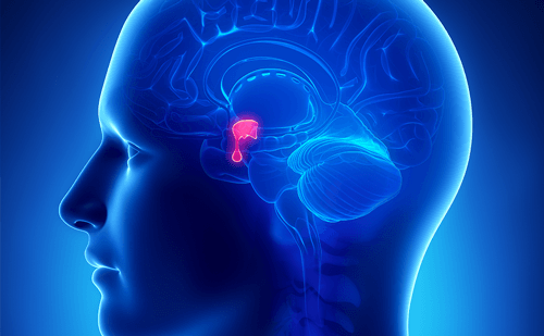 الورم الغدي النخامي: الأسباب والأعراض والتشخيص والعلاج