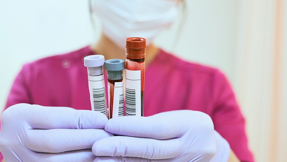 اختبار دموي سهل يمكنه الكشف عن أكثر من 50 نوعًا من السرطان