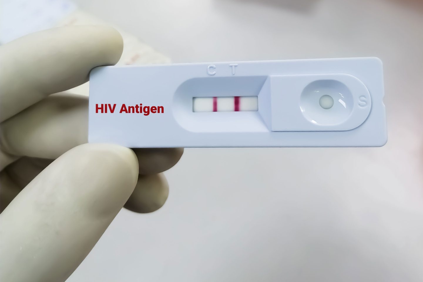 متى يكون فيروس HIV غير قابل للكشف وغير قابل للانتقال جنسيًا؟