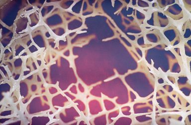 اكتشف العلماء سابقًا أن بكتيريا السل تنتقل في أرجاء الجسم عبر غزو الخلايا البلعمية الكبيرة، فما السبب العلمي وراء انتقالها؟