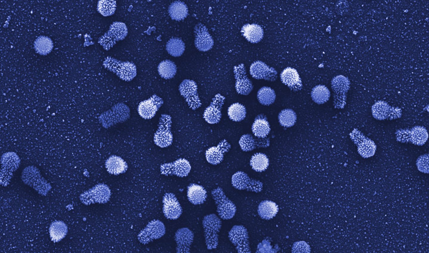 فيروسات عملاقة تحمل شيفرة وراثية قد تستطيع التحكم بعملية الاستقلاب عند الأحياء