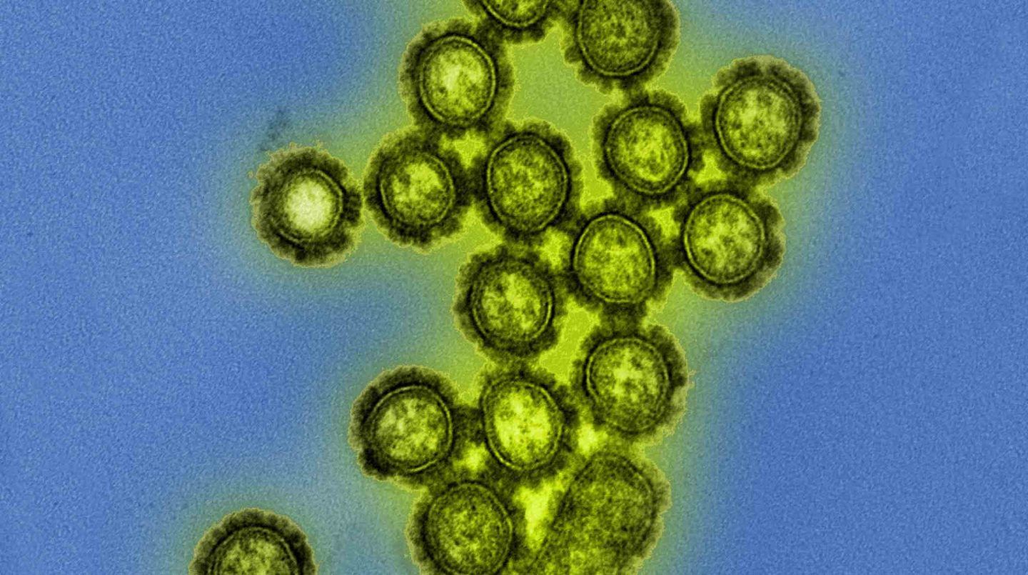 كيف يمكن للفيروسات أن تؤدي إلى حياة معقّدة؟